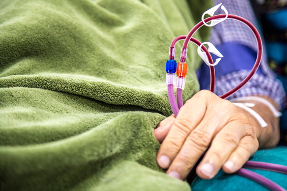 Upgrading your Home Dialysis Therapies Service